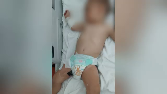 Anchetă în Iași după ce un copil de un an și jumătate a suferit arsuri grave după ce a căzut într-un ceaun cu apă fierbinte