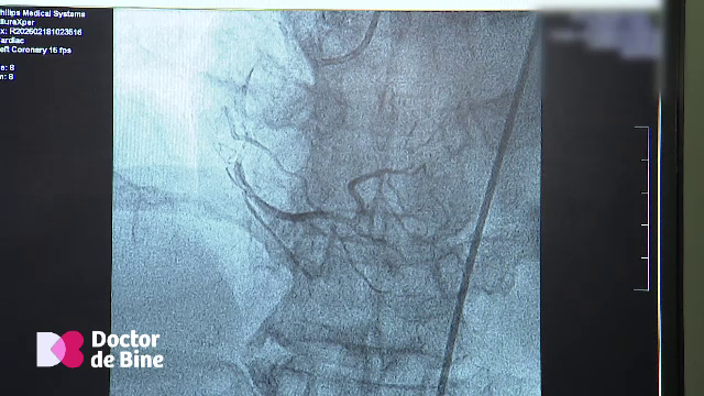 Cum prin doar 30 de minute de mișcare zilnică se produc vase noi de sânge