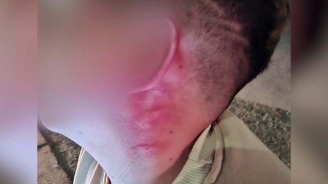 Un copil de 12 ani din Bistrița a fost strâns de gât de un bărbat necunoscut, după ce l-ar fi stropit din greșeală cu apă