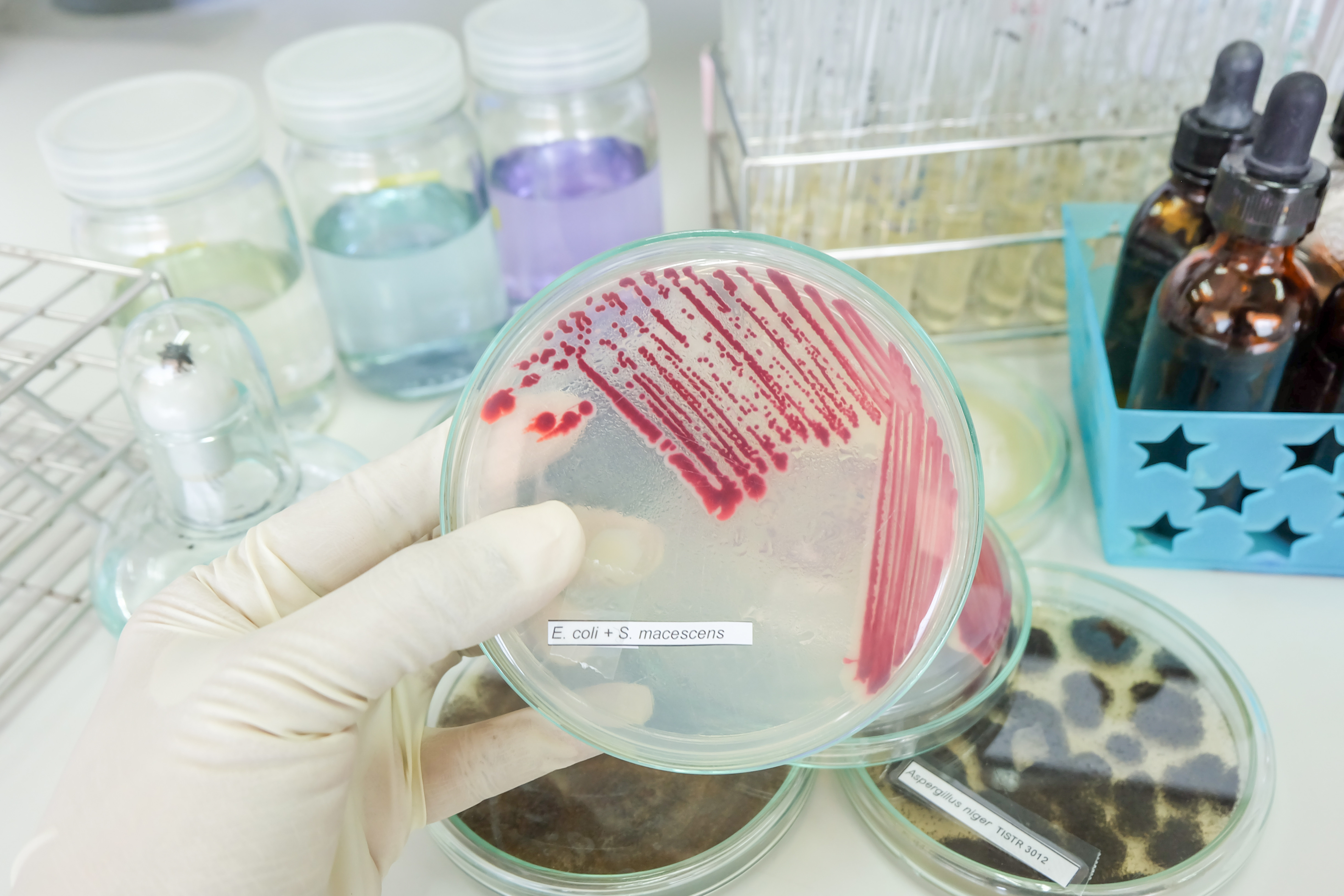 Opt bebeluși de la maternitatea din Târgu Mureș au fost infectați cu bacteria ucigașă de la Iași. Cum au scăpat cu viață