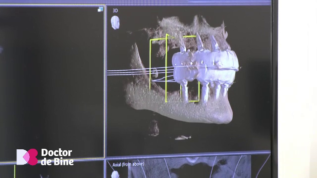 Dinții perfecți, creați digital: inteligența artificială și imprimarea 3D transformă estetica dentară