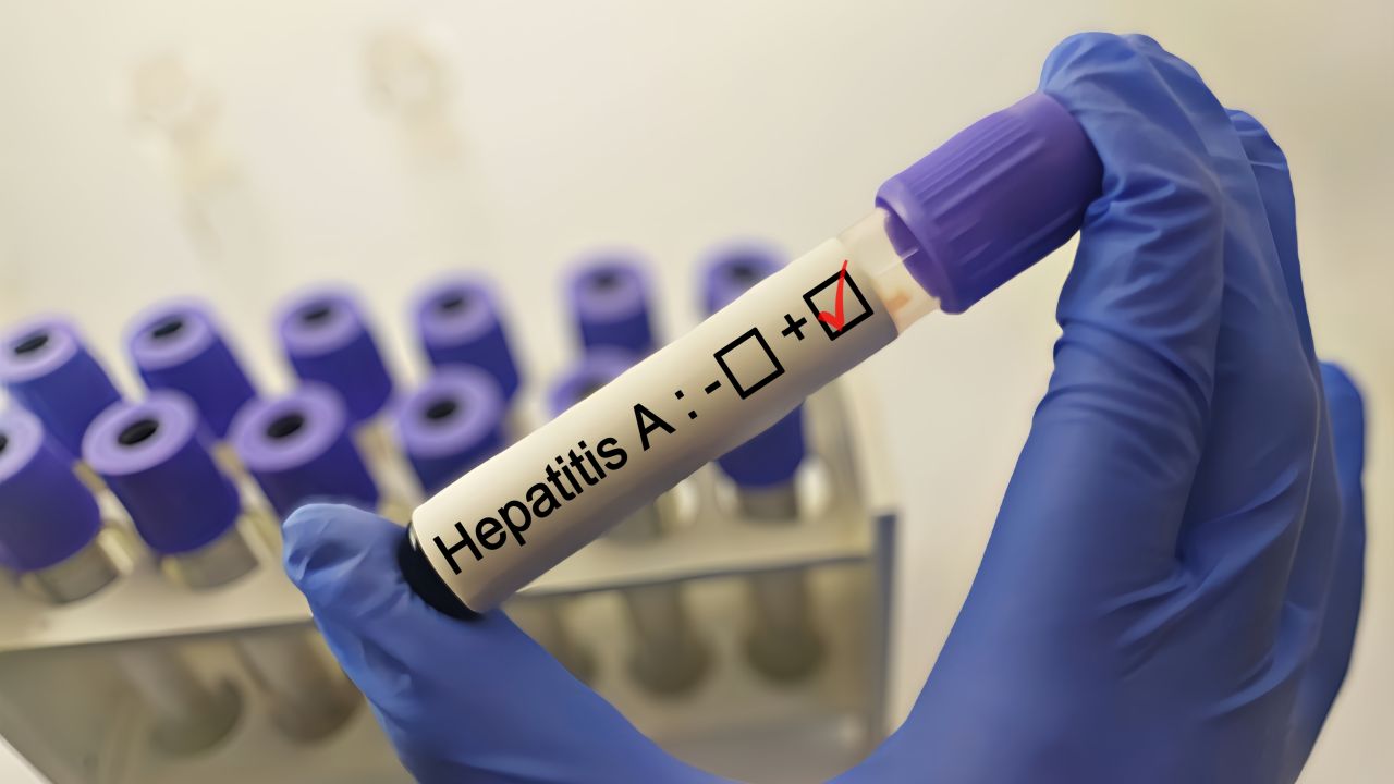 Focare de hepatită A în mai multe localități din Brașov. 85 de cazuri raportate de la începutul anului școlar