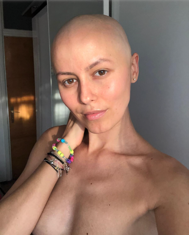 „Îţi dau părul meu, dar nu-mi lua nimic altceva”. Povestea de luptă a Andreei, modelul care a învins cancerul