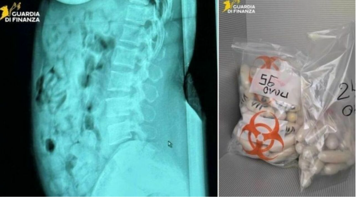 O româncă a fost arestată pe un aeroport din Italia, după ce a fost prinsă cu aproape 1,4 kg de droguri în stomac