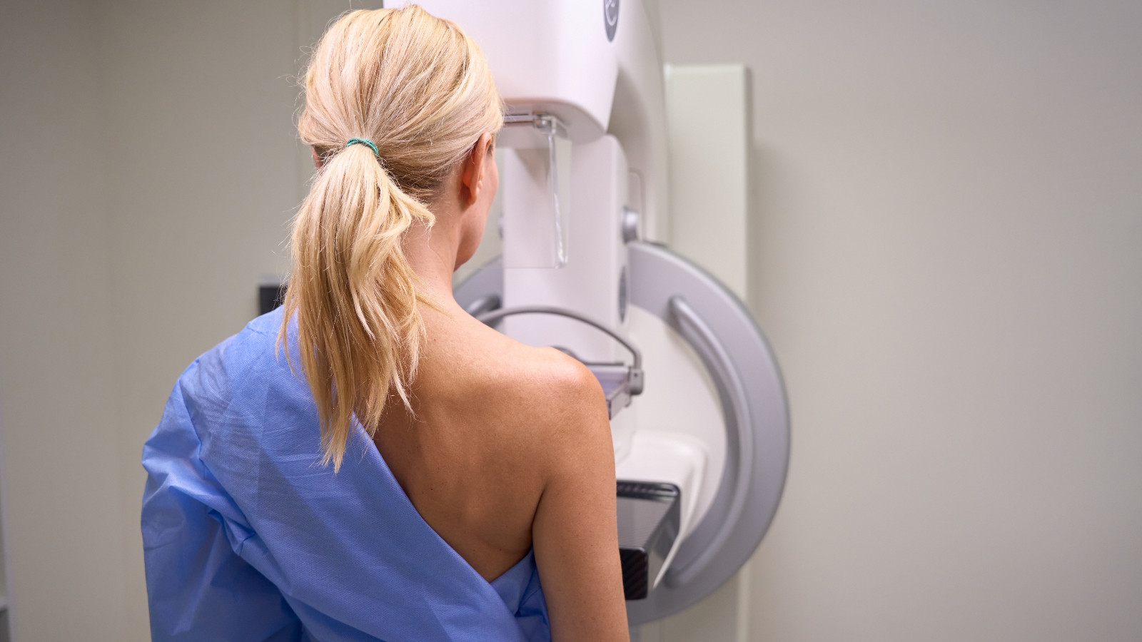 Un simplu test de sânge poate prezice ce tratament pentru cancerul de sân va funcționa cel mai bine, arată un studiu