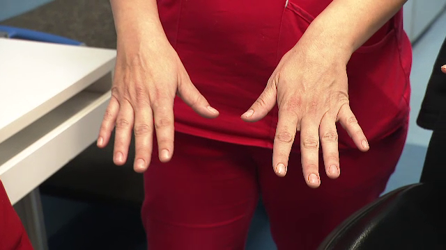 Spitalele impun reguli mai dure. Doctorițele și asistentele nu mai au voie cu unghii lungi, date cu ojă, și cu inele