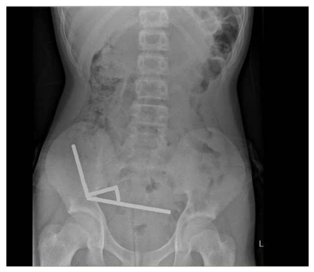 radiografie magneti stomac