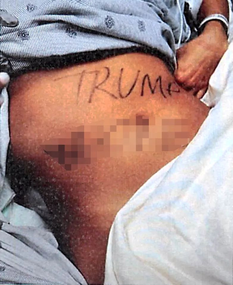 natalie green, tortura