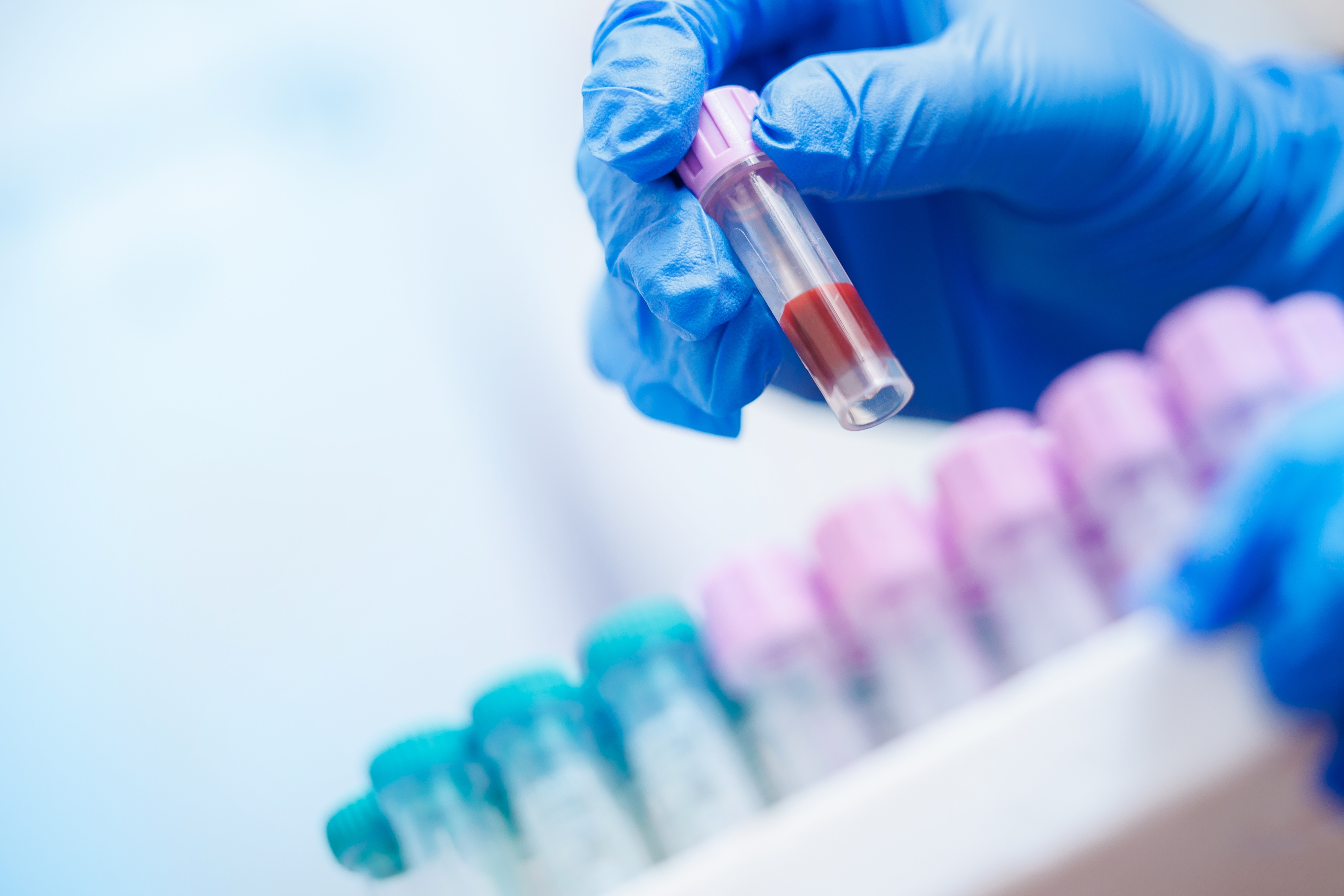 Studiu: Eliminarea celulelor „îmbătrânite” din vasele de sânge ar putea deveni o nouă cale de tratament pentru diabet