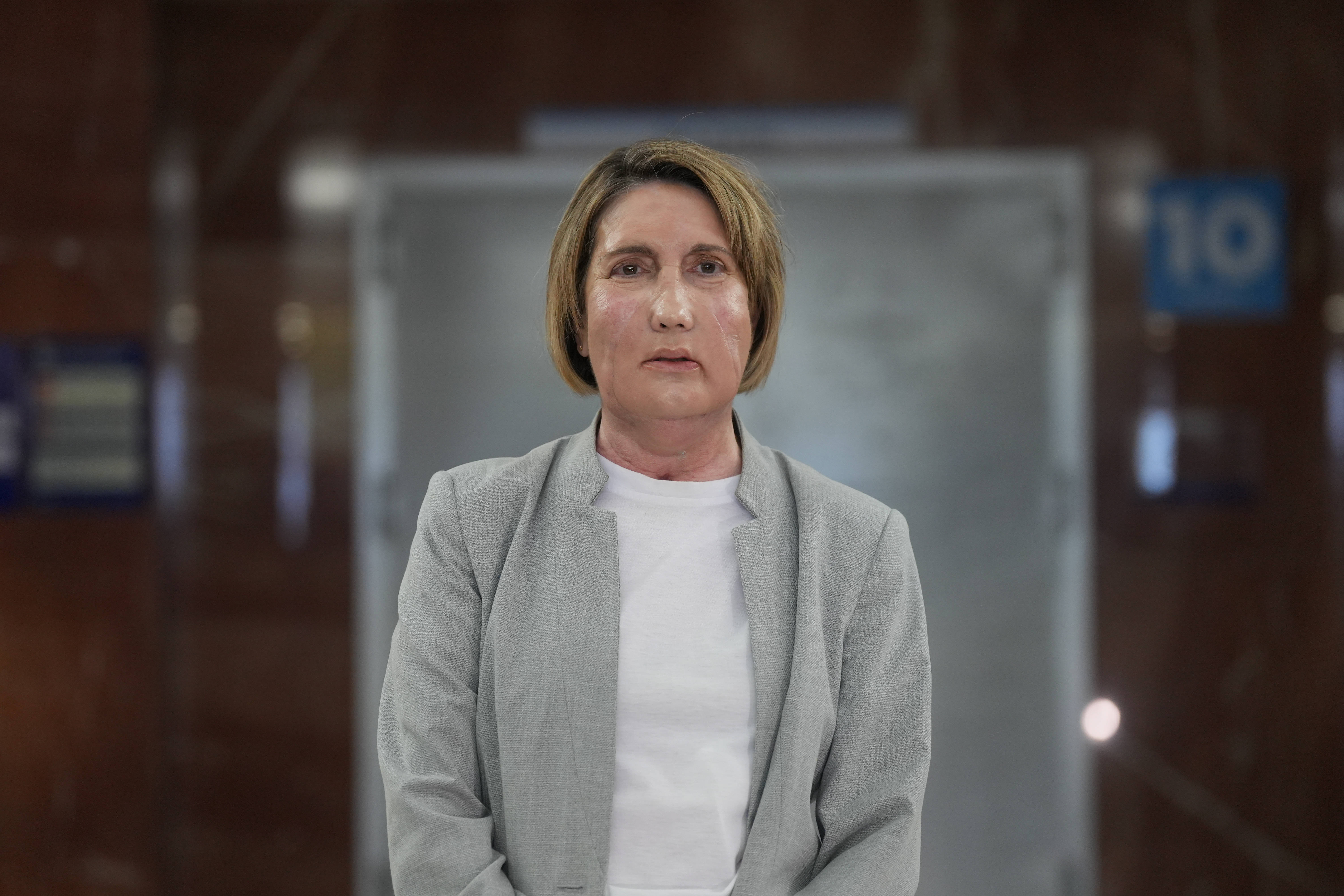 Un spital din Spania a realizat primul transplant de față din lume folosind un donator care a decedat prin eutanasiere