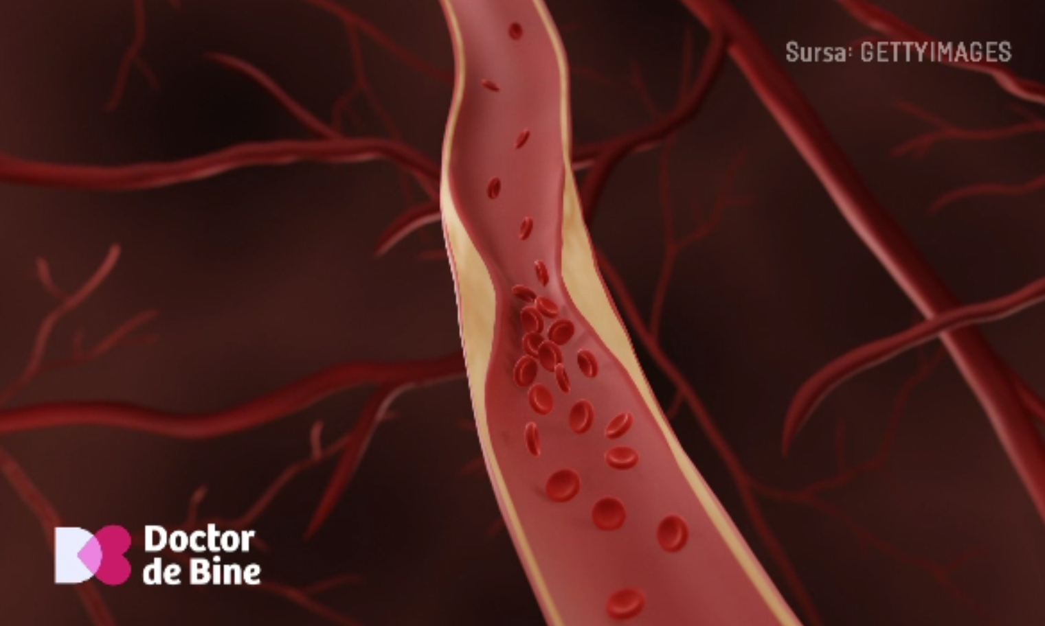 Analizele de sânge care arată riscul cardiovascular. Între hipertensiune și colesterol este o corelare negativă