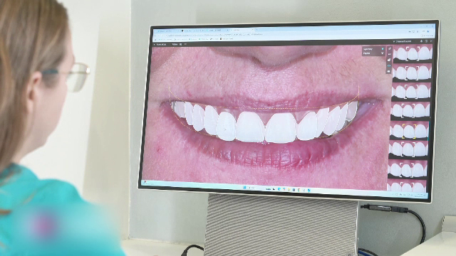 Inteligența artificială poate ajuta la proiectarea zâmbetului perfect, înainte de tratamentele dentare. Cum funcționează
