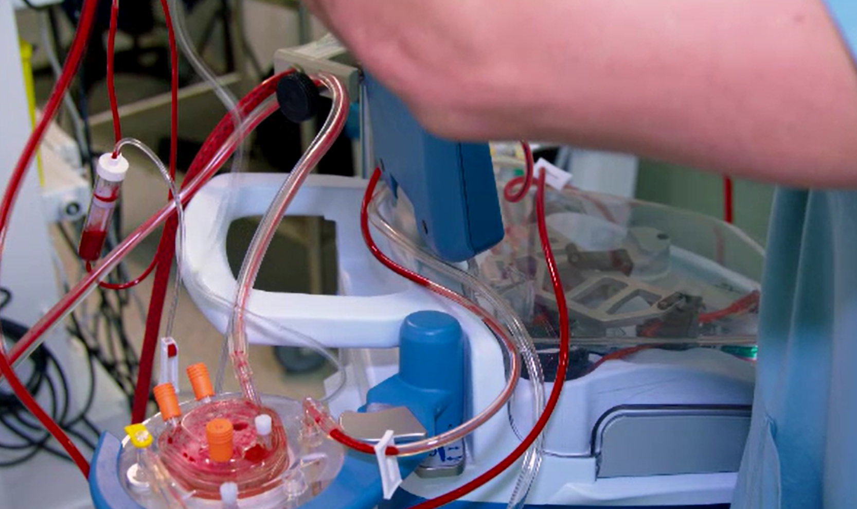 Scandal uriaș: membri ai clanului Cârpaci, acuzați că au obligat un bărbat să le doneze un rinichi și l-au ținut sclav