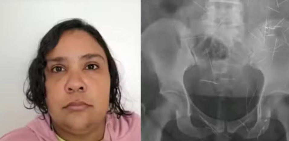 O femeie de 37 de ani din Brazilia s-a drept o fată de 12 ani pentru a păcăli o familie să o adopte. Ce a urmat