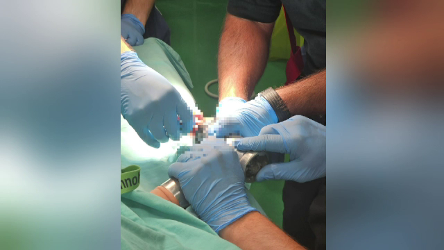 Un băiețel de 2 ani a rămas mutilat după ce și-a prins mâna într-un tocător electric, în Mureș