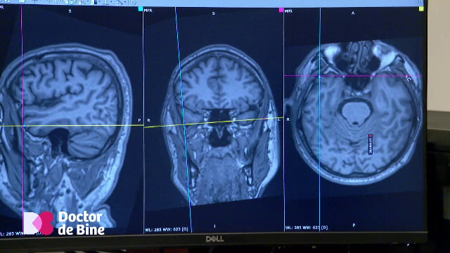 Copiii care se uită în gol pot avea o criză de epilepsie. Cum o deosebim de o simplă plictiseală
