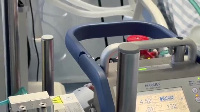 De ce este important ca spitalele să fie dotate cu ”ECMO”. Acest aparat complex poate face diferența dintre viață și moarte