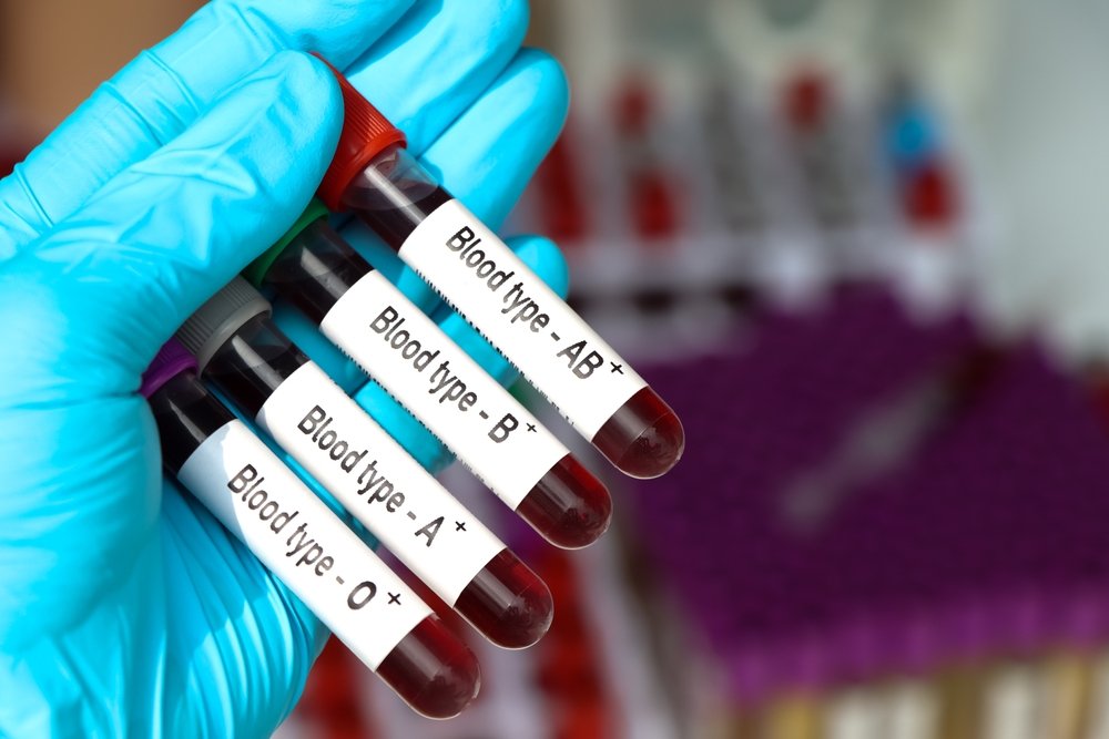 Studiu. Există o grupă de sânge care ar putea avea un risc mai ridicat pentru dezvoltarea diabetului de tip 2