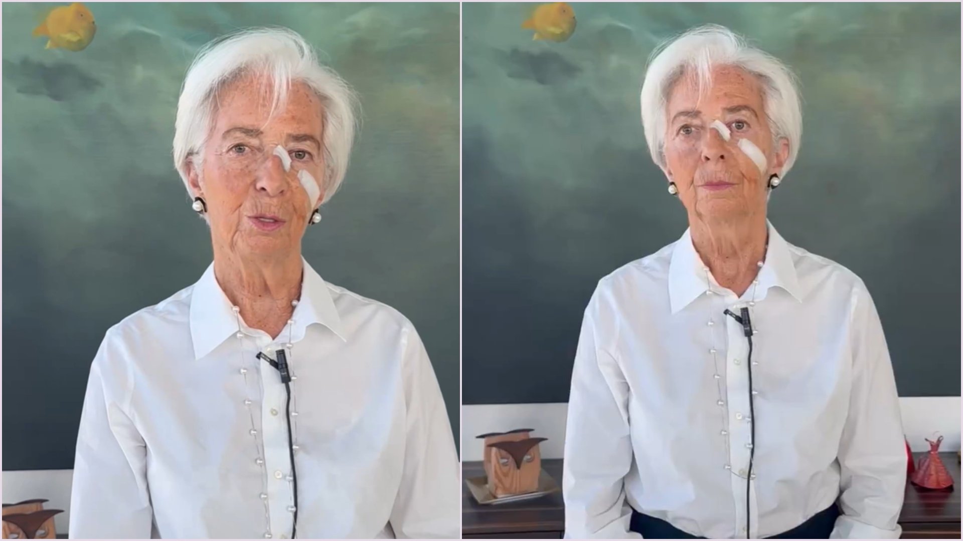 Christine Lagarde a explicat de ce a apărut cu plasturi pe față: „Nu e de la kick-boxing în Thailanda”
